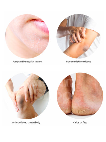 TAE JAENG YI Body And Face Peeling Gel